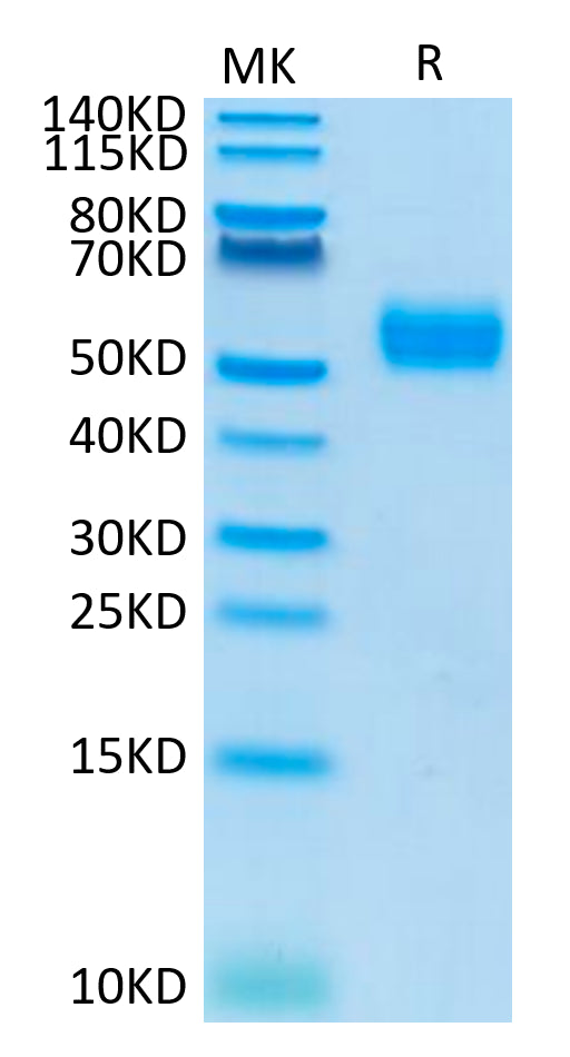 Human SIRP alpha V4 on Tris-Bis PAGE under reduced condition. The purity is greater than 95%.Recombinant Human SIRP alpha V4 Protein, Active