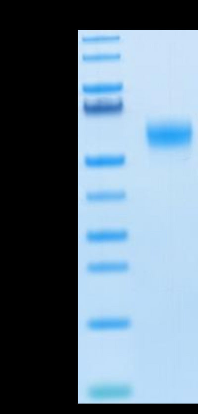 Human SIRP alpha V6 on Tris-Bis PAGE under reduced condition. The purity is greater than 95%.Recombinant Human SIRP alpha V6 Protein, Active