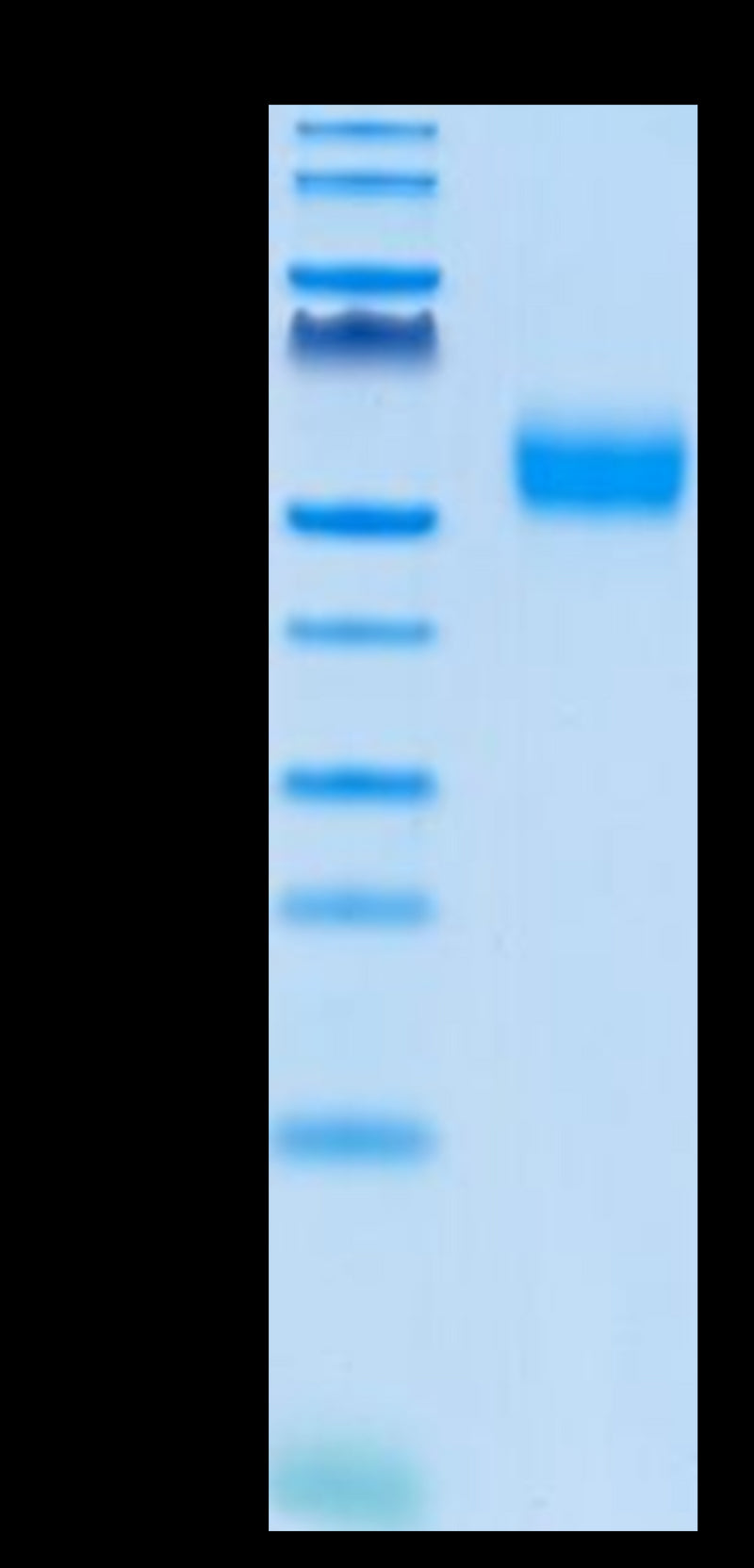 Biotinylated Human SIRP alpha V4 on Tris-Bis PAGE under reduced condition. The purity is greater than 95%.Biotinylated Human SIRP alpha V4 Protein, Active