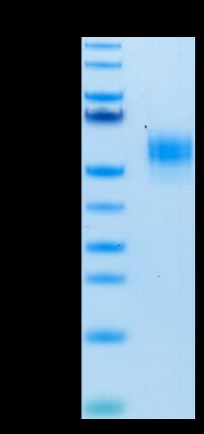Human SIRP alpha V3 on Tris-Bis PAGE under reduced condition. The purity is greater than 95%.Recombinant Human SIRP alpha V3 Protein, Active