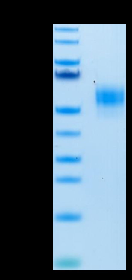 Human SIRP alpha V3 on Tris-Bis PAGE under reduced condition. The purity is greater than 95%.Recombinant Human SIRP alpha V3 Protein, Active