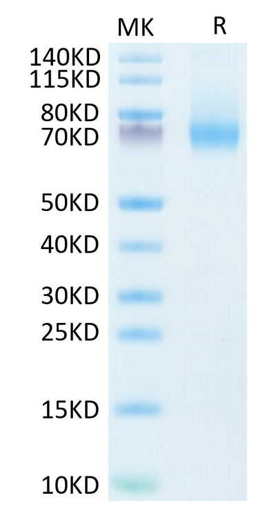 Human IL-7R alpha on Tris-Bis PAGE under reduced condition. The purity is greater than 95%.Recombinant Human IL-7R alpha/CD127 Protein, Active