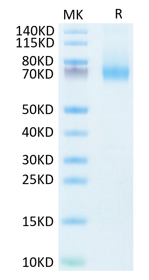 Human IL-7R alpha on Tris-Bis PAGE under reduced condition. The purity is greater than 95%.Recombinant Human IL-7R alpha/CD127 Protein, Active