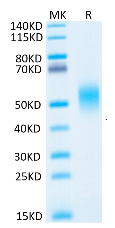 Human IL-7R alpha on Tris-Bis PAGE under reduced condition. The purity is greater than 95%.Recombinant Human IL-7R alpha/CD127 Protein, Active