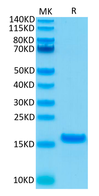 Human IL-21 on Tris-Bis PAGE under reduced condition. The purity is greater than 95%.Recombinant Human IL-21 Protein, Active