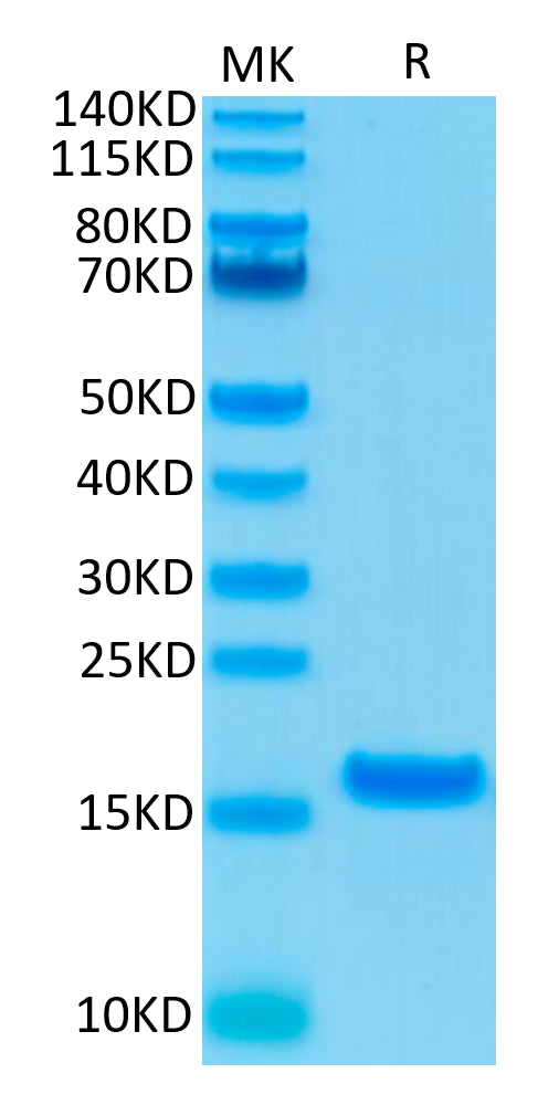 Human IL-21 on Tris-Bis PAGE under reduced condition. The purity is greater than 95%.Recombinant Human IL-21 Protein, Active