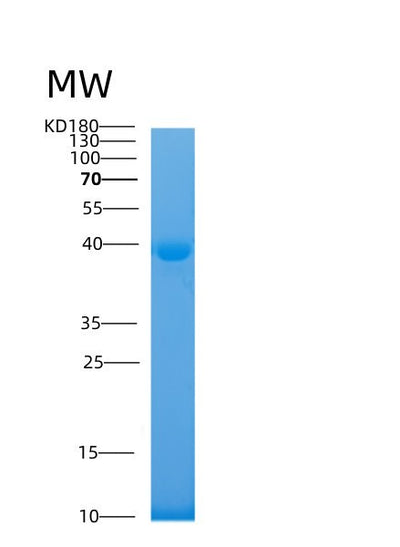 SDS-PAGE analysis of Human MAPT (Microtubule-Associated Protein Tau) - Recombinant Protein, CAT# BLT-00001P, showing >95% purity under 15% SDS-PAGE (Reduced)Human MAPT (Microtubule-Associated Protein Tau) - Recombinant Protein