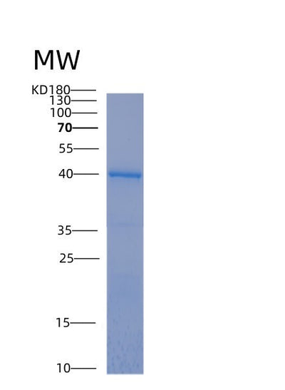 SDS-PAGE analysis of Human MAPT (Microtubule-Associated Protein Tau) - Recombinant Protein, CAT# BLT-00003P, showing >85% purity under 15% SDS-PAGE (Reduced)Human MAPT (Microtubule-Associated Protein Tau) - Recombinant Protein