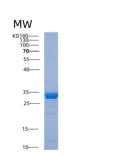 SDS-PAGE analysis of Human ABHD10 (Palmitoyl-Protein Thioesterase Abhd10, Mitochondrial) - Recombinant Protein, CAT# BLT-00016P, showing >95% purity under 15% SDS-PAGE (Reduced)Human ABHD10 (Palmitoyl-Protein Thioesterase Abhd10, Mitochondrial) - Recombinant Protein