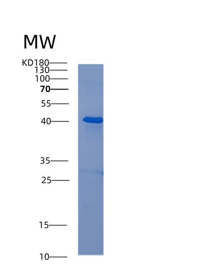 SDS-PAGE analysis of Human ABI3 (Abi Gene Family Member 3) - Recombinant Protein, CAT# BLT-00019P, showing >95% purity under 15% SDS-PAGE (Reduced)Human ABI3 (Abi Gene Family Member 3) - Recombinant Protein