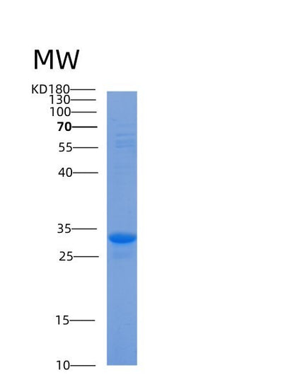 SDS-PAGE analysis of Human ACBD6 (Acyl-Coa-Binding Domain-Containing Protein 6) - Recombinant Protein, CAT# BLT-00032P, showing >90% purity under 15% SDS-PAGE (Reduced)Human ACBD6 (Acyl-Coa-Binding Domain-Containing Protein 6) - Recombinant Protein
