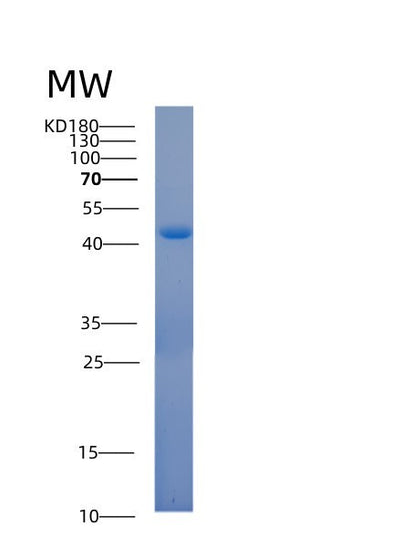 SDS-PAGE analysis of Human ACOT7 (Cytosolic Acyl Coenzyme A Thioester Hydrolase) - Recombinant Protein, CAT# BLT-00037P, showing >90% purity under 15% SDS-PAGE (Reduced)Human ACOT7 (Cytosolic Acyl Coenzyme A Thioester Hydrolase) - Recombinant Protein