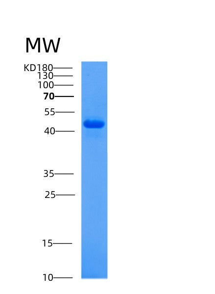 SDS-PAGE analysis of Human ACP2 (Lysosomal Acid Phosphatase) - Recombinant Protein, CATHuman ACP2 (Lysosomal Acid Phosphatase) - Recombinant Protein