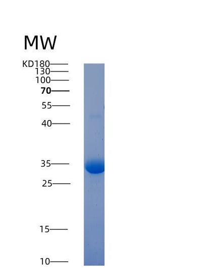 SDS-PAGE analysis of Human ACP5 (Tartrate-Resistant Acid Phosphatase Type 5) - Recombinant Protein, CAT# BLT-00040P, showing >90% purity under 15% SDS-PAGE (Reduced)Human ACP5 (Tartrate-Resistant Acid Phosphatase Type 5) - Recombinant Protein