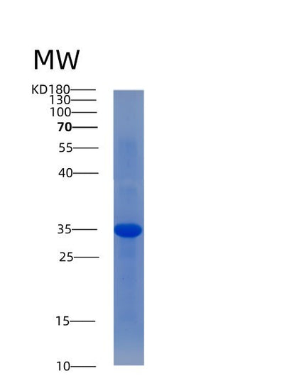 SDS-PAGE analysis of Human ACP5 (Tartrate-Resistant Acid Phosphatase Type 5) - Recombinant Protein, CAT# BLT-00041P, showing >85% purity under 15% SDS-PAGE (Reduced)Human ACP5 (Tartrate-Resistant Acid Phosphatase Type 5) - Recombinant Protein