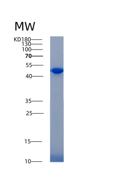 SDS-PAGE analysis of Human ACP3 (Prostatic Acid Phosphatase) - Recombinant Protein, CAT# BLT-00043P, showing >90% purity under 15% SDS-PAGE (Reduced)Human ACP3 (Prostatic Acid Phosphatase) - Recombinant Protein