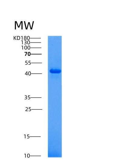 SDS-PAGE analysis of Human ACP3 (Prostatic Acid Phosphatase) - Recombinant Protein, CAT# BLT-00044P, showing >85% purity under 15% SDS-PAGE (Reduced)Human ACP3 (Prostatic Acid Phosphatase) - Recombinant Protein