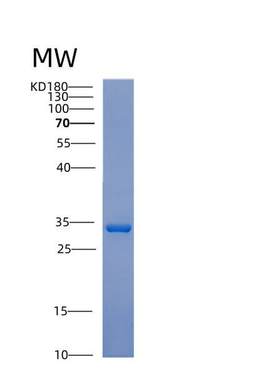 SDS-PAGE analysis of Human ACTN1 (Alpha-Actinin-1) - Recombinant Protein, CAT# BLT-00048P, showing >95% purity under 15% SDS-PAGE (Reduced)Human ACTN1 (Alpha-Actinin-1) - Recombinant Protein