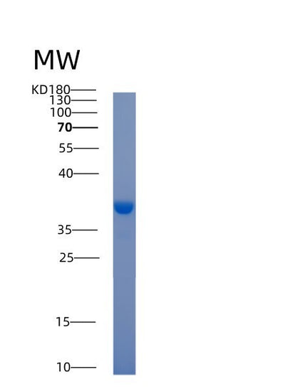 SDS-PAGE analysis of Human ACY3 (N-Acyl-Aromatic-L-Amino Acid Amidohydrolase (Carboxylate-Forming)) - Recombinant Protein, CAT# BLT-00053P, showing >85% purity under 15% SDS-PAGE (Reduced)Human ACY3 (N-Acyl-Aromatic-L-Amino Acid Amidohydrolase (Carboxylate-Forming)) - Recombinant Protein