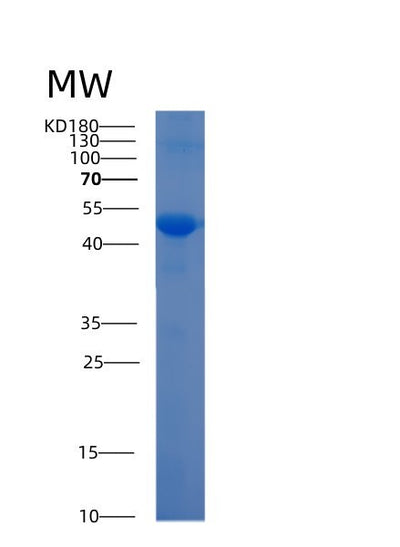 SDS-PAGE analysis of Human ADAM10 (Disintegrin And Metalloproteinase Domain-Containing Protein 10) - Recombinant Protein, CAT# BLT-02887P, showing >90% purity under 15% SDS-PAGE (Reduced)Human ADAM10 (Disintegrin And Metalloproteinase Domain-Containing Protein 10) - Recombinant Protein