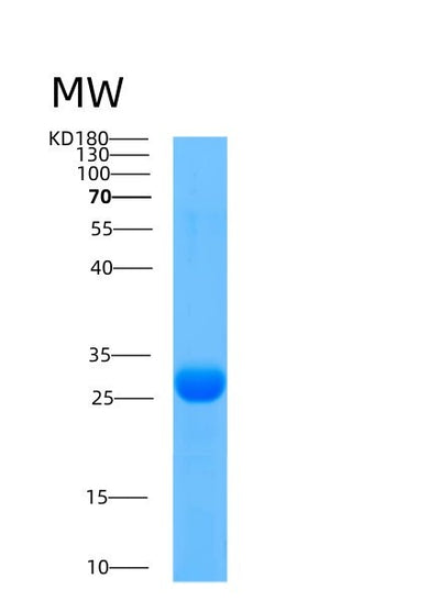SDS-PAGE analysis of Human AK3 (Gtp:Amp Phosphotransferase Ak3, Mitochondrial) - Recombinant Protein, CAT# BLT-00058P, showing >85% purity under 15% SDS-PAGE (Reduced)Human AK3 (Gtp:Amp Phosphotransferase Ak3, Mitochondrial) - Recombinant Protein