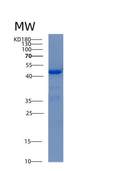 SDS-PAGE analysis of Human ADH5 (Alcohol Dehydrogenase Class-3) - Recombinant Protein, CAT# BLT-00063P, showing >90% purity under 15% SDS-PAGE (Reduced)Human ADH5 (Alcohol Dehydrogenase Class-3) - Recombinant Protein
