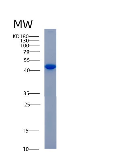 SDS-PAGE analysis of Human ADH6 (Alcohol Dehydrogenase 6) - Recombinant Protein, CAT# BLT-00064P, showing >85% purity under 15% SDS-PAGE (Reduced)Human ADH6 (Alcohol Dehydrogenase 6) - Recombinant Protein
