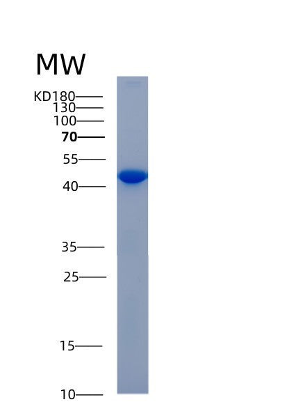 SDS-PAGE analysis of Human ADH6 (Alcohol Dehydrogenase 6) - Recombinant Protein, CATHuman ADH6 (Alcohol Dehydrogenase 6) - Recombinant Protein