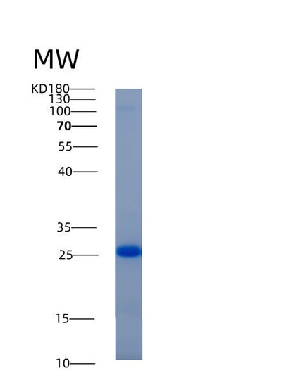 SDS-PAGE analysis of Human ADI1 (Acireductone Dioxygenase) - Recombinant Protein, CAT# BLT-00065P, showing >95% purity under 15% SDS-PAGE (Reduced)Human ADI1 (Acireductone Dioxygenase) - Recombinant Protein