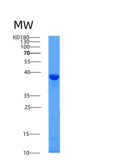 SDS-PAGE analysis of Human AFAP1 (Actin Filament-Associated Protein 1) - Recombinant Protein, CAT# BLT-00077P, showing >95% purity under 15% SDS-PAGE (Reduced)Human AFAP1 (Actin Filament-Associated Protein 1) - Recombinant Protein
