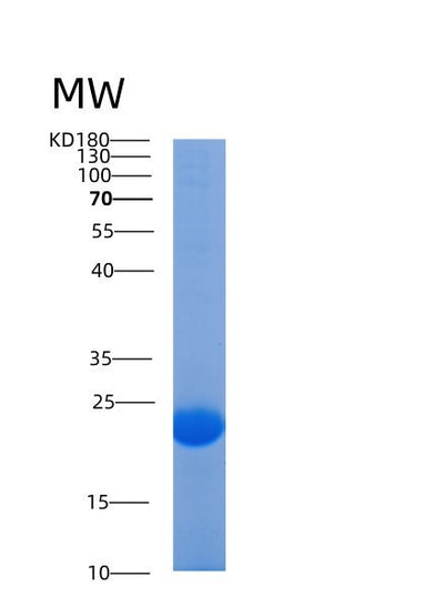SDS-PAGE analysis of Human AGR2 (Anterior Gradient Protein 2 Homolog) - Recombinant Protein, CAT# BLT-00081P, showing >90% purity under 15% SDS-PAGE (Reduced)Human AGR2 (Anterior Gradient Protein 2 Homolog) - Recombinant Protein