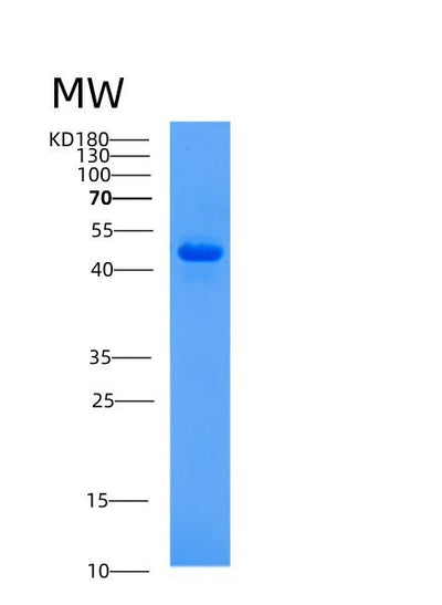 SDS-PAGE analysis of Human AHCY (Adenosylhomocysteinase) - Recombinant Protein, CAT# BLT-00085P, showing >85% purity under 15% SDS-PAGE (Reduced)Human AHCY (Adenosylhomocysteinase) - Recombinant Protein
