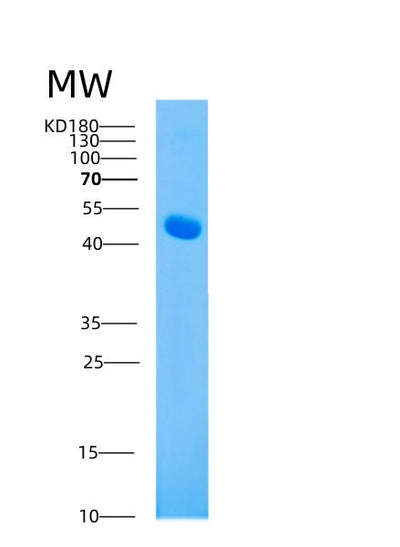 SDS-PAGE analysis of Mouse Ahsg (Alpha-2-Hs-Glycoprotein) - Recombinant Protein, CAT# BLT-00086P, showing >95% purity under 15% SDS-PAGE (Reduced)Mouse Ahsg (Alpha-2-Hs-Glycoprotein) - Recombinant Protein