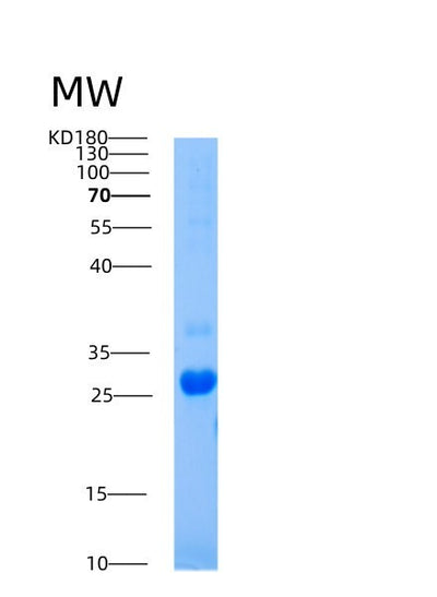 SDS-PAGE analysis of Human AICDA (Single-Stranded Dna Cytosine Deaminase) - Recombinant Protein, CAT# BLT-00089P, showing >95% purity under 15% SDS-PAGE (Reduced)Human AICDA (Single-Stranded Dna Cytosine Deaminase) - Recombinant Protein