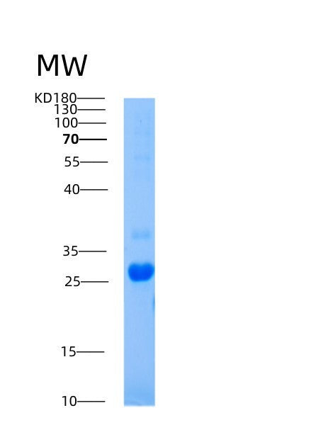 SDS-PAGE analysis of Human AICDA (Single-Stranded Dna Cytosine Deaminase) - Recombinant Protein, CATHuman AICDA (Single-Stranded Dna Cytosine Deaminase) - Recombinant Protein