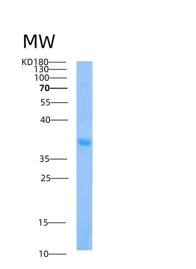 SDS-PAGE analysis of Human AIDA (Axin Interactor, Dorsalization-Associated Protein) - Recombinant Protein, CAT# BLT-00090P, showing >90% purity under 15% SDS-PAGE (Reduced)Human AIDA (Axin Interactor, Dorsalization-Associated Protein) - Recombinant Protein