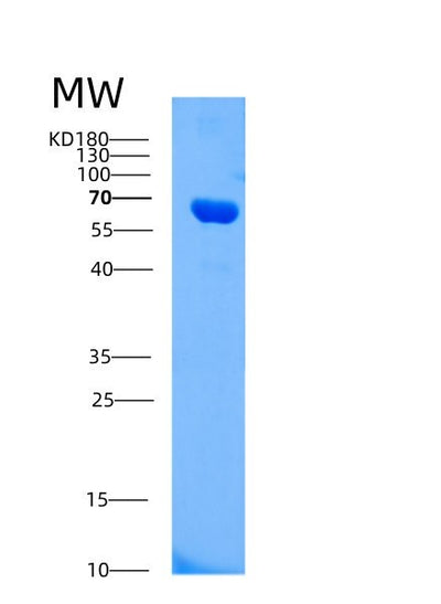 SDS-PAGE analysis of Human AIFM1 (Apoptosis-Inducing Factor 1, Mitochondrial) - Recombinant Protein, CAT# BLT-00093P, showing >90% purity under 15% SDS-PAGE (Reduced)Human AIFM1 (Apoptosis-Inducing Factor 1, Mitochondrial) - Recombinant Protein