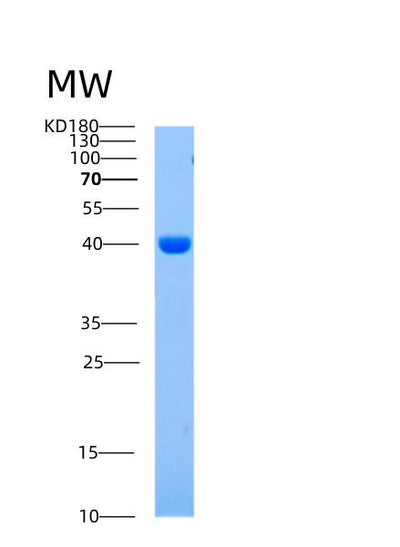 SDS-PAGE analysis of Human AIMP1 (Aminoacyl Trna Synthase Complex-Interacting Multifunctional Protein 1) - Recombinant Protein, CAT# BLT-00095P, showing >95% purity under 15% SDS-PAGE (Reduced)Human AIMP1 (Aminoacyl Trna Synthase Complex-Interacting Multifunctional Protein 1) - Recombinant Protein