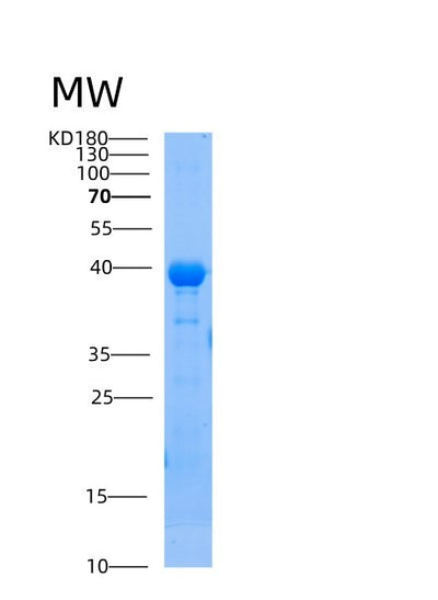SDS-PAGE analysis of Human AIP (Ah Receptor-Interacting Protein) - Recombinant Protein, CAT# BLT-00097P, showing >85% purity under 15% SDS-PAGE (Reduced)Human AIP (Ah Receptor-Interacting Protein) - Recombinant Protein