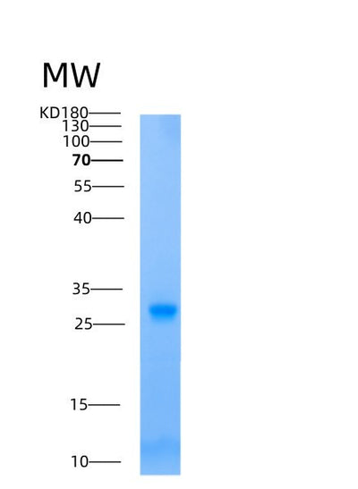 SDS-PAGE analysis of Human Adenylate Kinase 2 (AK2) - Recombinant Protein, CAT# BLT-00099P, showing >90% purity under 15% SDS-PAGE (Reduced)Human Adenylate Kinase 2 (AK2) - Recombinant Protein