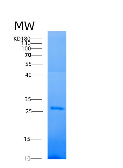 SDS-PAGE analysis of Human AK4 (Adenylate Kinase 4, Mitochondrial) - Recombinant Protein, CAT# BLT-00100P, showing >85% purity under 15% SDS-PAGE (Reduced)Human AK4 (Adenylate Kinase 4, Mitochondrial) - Recombinant Protein