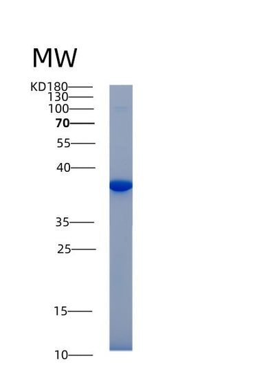 SDS-PAGE analysis of Mouse Akr1b1 (Aldo-Keto Reductase Family 1 Member B1) - Recombinant Protein, CAT# BLT-00103P, showing >85% purity under 15% SDS-PAGE (Reduced)Mouse Akr1b1 (Aldo-Keto Reductase Family 1 Member B1) - Recombinant Protein