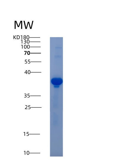 SDS-PAGE analysis of Human AKR1D1 (Aldo-Keto Reductase Family 1 Member D1) - Recombinant Protein, CAT# BLT-00108P, showing >90% purity under 15% SDS-PAGE (Reduced)Human AKR1D1 (Aldo-Keto Reductase Family 1 Member D1) - Recombinant Protein