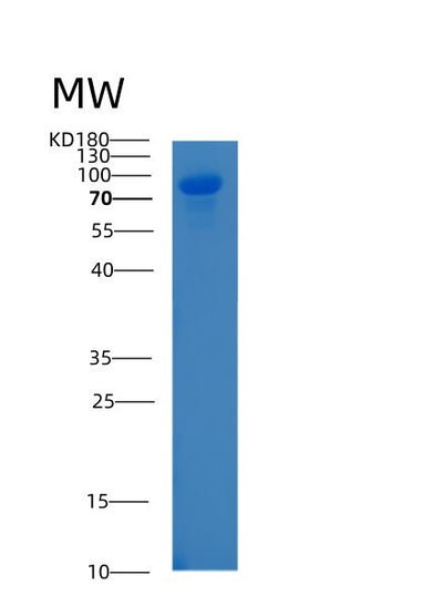 SDS-PAGE analysis of Human ALCAM (Cd166 Antigen) - Recombinant Protein, CAT# BLT-00116P, showing >85% purity under 15% SDS-PAGE (Reduced)Human ALCAM (Cd166 Antigen) - Recombinant Protein