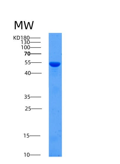 SDS-PAGE analysis of Human ALDH1A1 (Aldehyde Dehydrogenase 1A1) - Recombinant Protein, CAT# BLT-00118P, showing >90% purity under 15% SDS-PAGE (Reduced)Human ALDH1A1 (Aldehyde Dehydrogenase 1A1) - Recombinant Protein