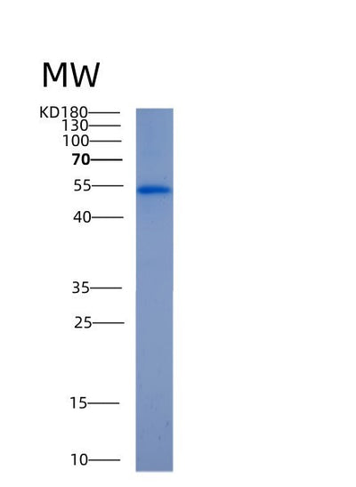 SDS-PAGE analysis of Human ALDH2 (Aldehyde Dehydrogenase, Mitochondrial) - Recombinant Protein, CAT# BLT-00120P, showing >95% purity under 15% SDS-PAGE (Reduced)Human ALDH2 (Aldehyde Dehydrogenase, Mitochondrial) - Recombinant Protein
