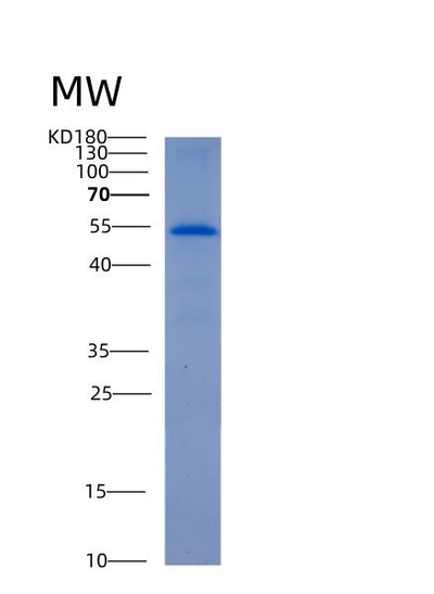 SDS-PAGE analysis of Human ALDH6A1 (Methylmalonate-Semialdehyde/Malonate-Semialdehyde Dehydrogenase [Acylating], Mitochondrial) - Recombinant Protein, CAT# BLT-00123P, showing >95% purity under 15% SDS-PAGE (Reduced)Human ALDH6A1 (Methylmalonate-Semialdehyde/Malonate-Semialdehyde Dehydrogenase [Acylating], Mitochondrial) - Recombinant Protein