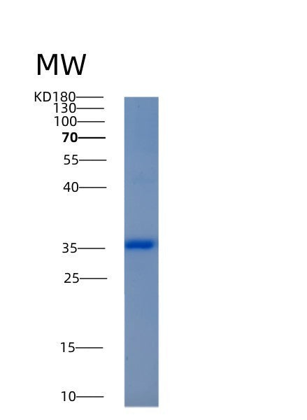 SDS-PAGE analysis of Human AKR1C4 (Aldo-Keto Reductase Family 1 Member C4) - Recombinant Protein, CATHuman AKR1C4 (Aldo-Keto Reductase Family 1 Member C4) - Recombinant Protein