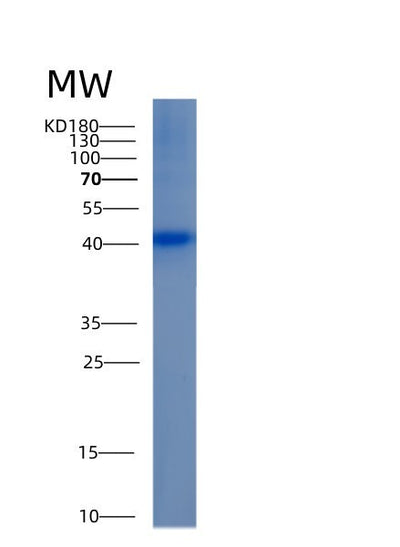 SDS-PAGE analysis of Human ALDOB (Fructose-Bisphosphate Aldolase B) - Recombinant Protein, CAT# BLT-00127P, showing >90% purity under 15% SDS-PAGE (Reduced)Human ALDOB (Fructose-Bisphosphate Aldolase B) - Recombinant Protein