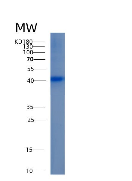 SDS-PAGE analysis of Human ALDOB (Fructose-Bisphosphate Aldolase B) - Recombinant Protein, CATHuman ALDOB (Fructose-Bisphosphate Aldolase B) - Recombinant Protein